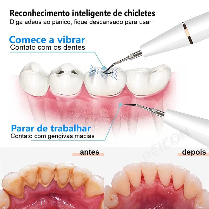 Removedor de tártaro e cálculos dentais ultrassônico elétrico para limpeza de placa bacteriana e remoção de pedra dental nos dentes