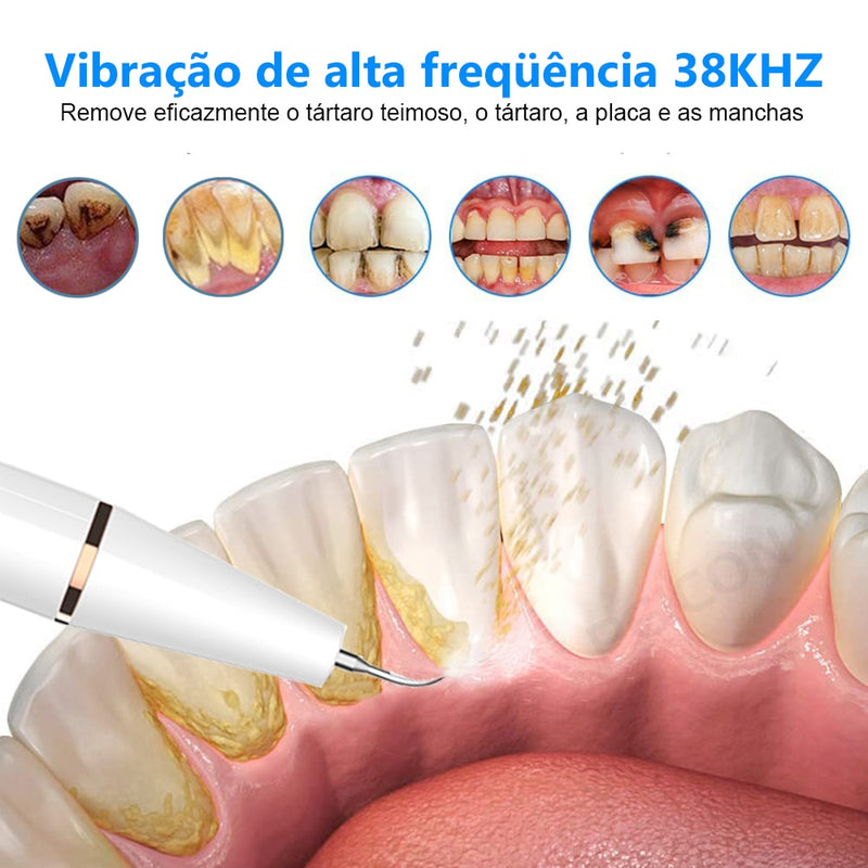 Removedor de tártaro e cálculos dentais ultrassônico elétrico para limpeza de placa bacteriana e remoção de pedra dental nos dentes